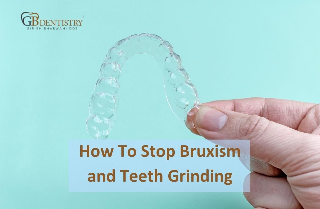 Bruxism - GB Dentistry