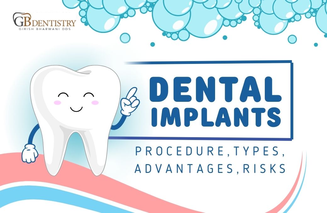Dental Implants: Procedure, Types, Advantages, Risks
