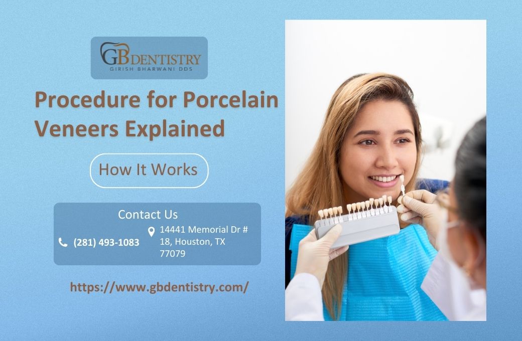 Procedure for Porcelain Veneers Explained – How It Works