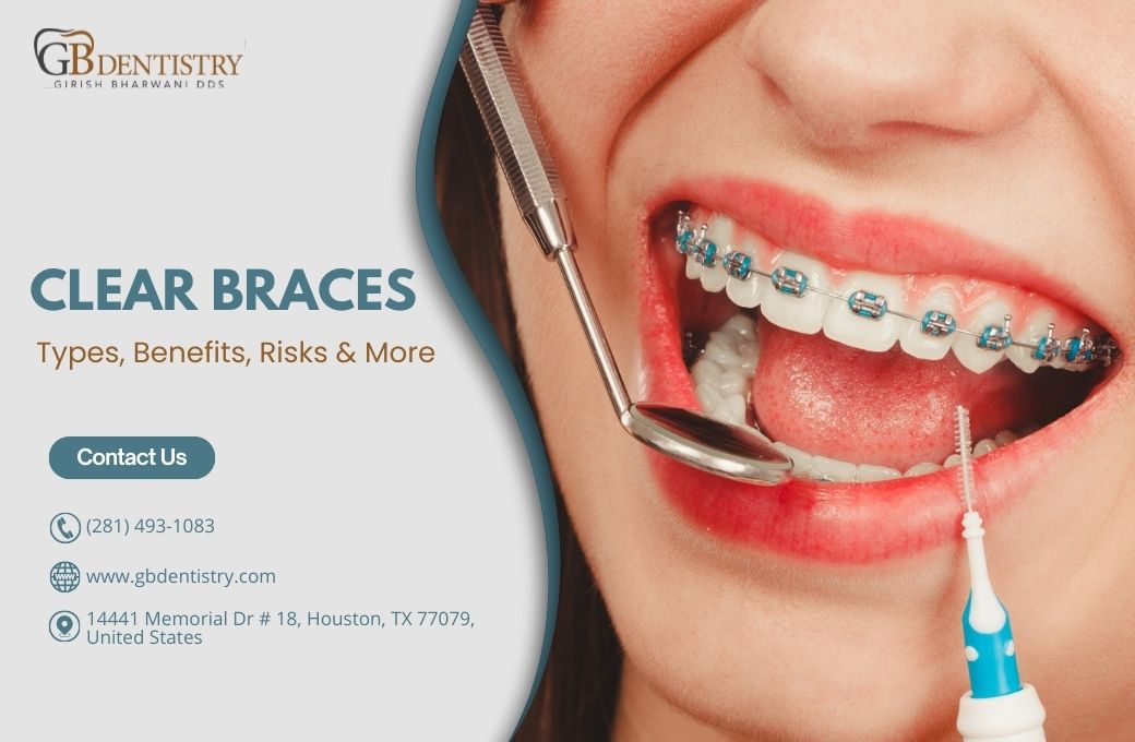 Clear Braces – Types, Benefits, Risks & More