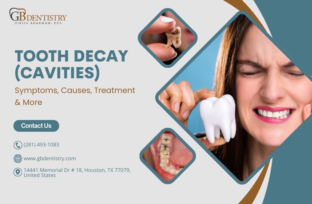 Tooth Decay (Cavities) – Symptoms, Causes, Treatment & More