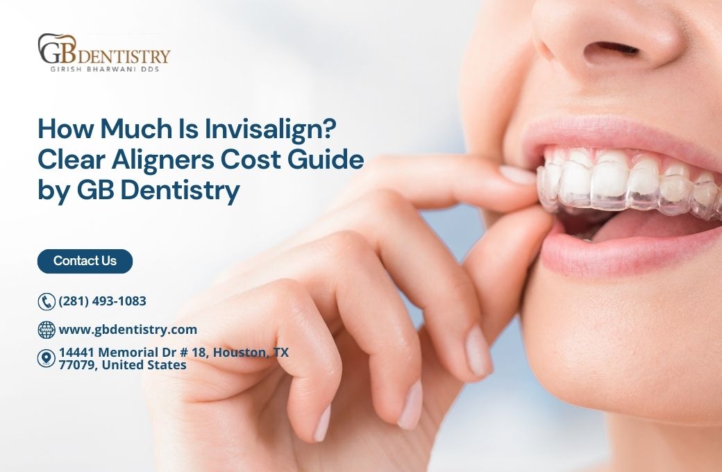 How Much Is Invisalign? Clear Aligners Cost Guide by GB Dentistry