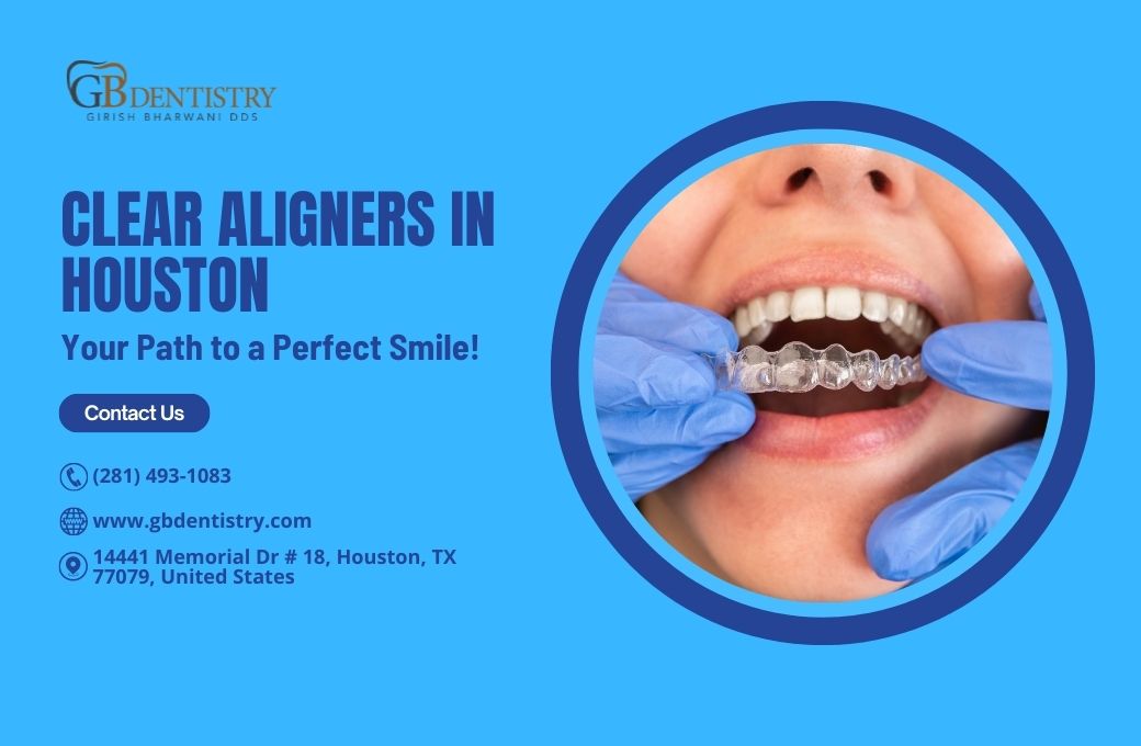 Clear Aligners Near You in Houston: Your Path to a Perfect Smile!