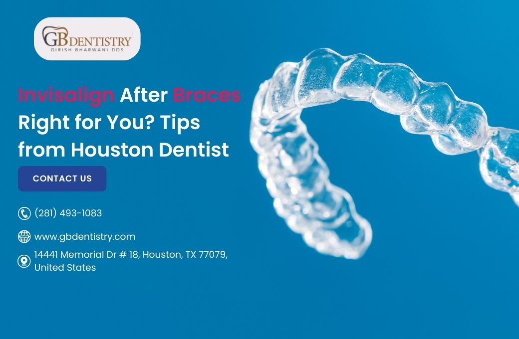 Invisalign After Braces Right for You? Tips from Houston Dentist