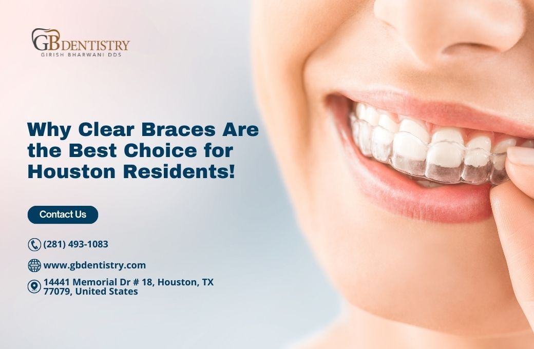 Why Clear Braces Are the Best Choice for Houston Residents!